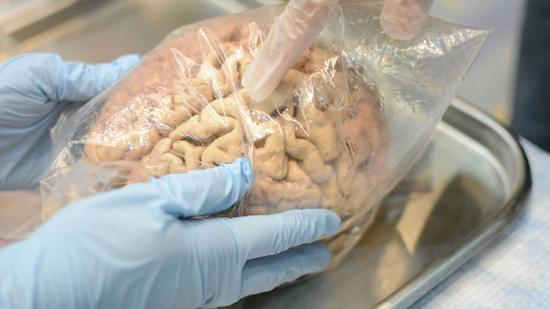 Hey, Egghead: What Do You Know About Your Brain? Find out at the Brain Health Fair, April 15 (Free Prize Giveaway!)