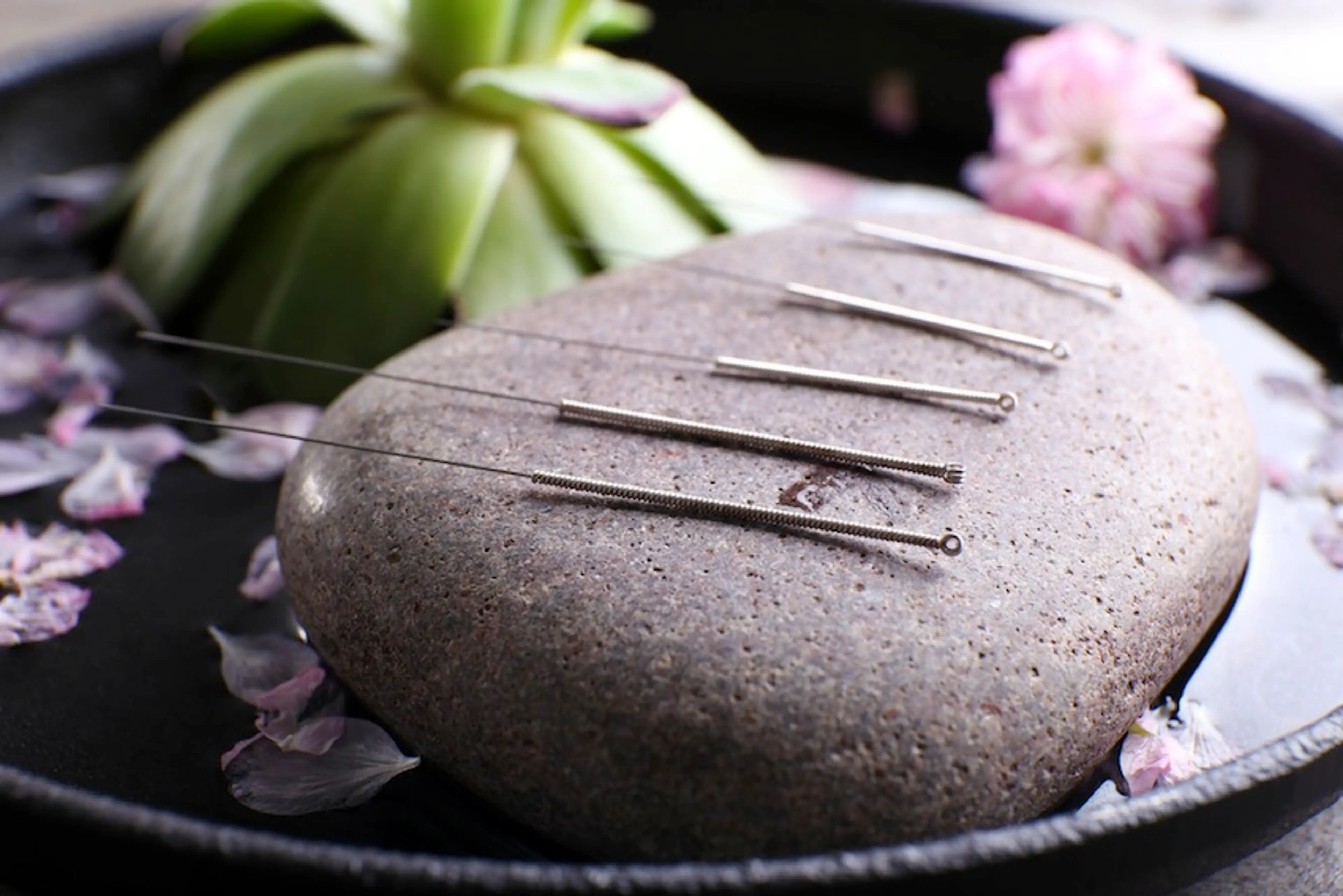 Everything You Need to Know About Community Acupuncture in Vancouver