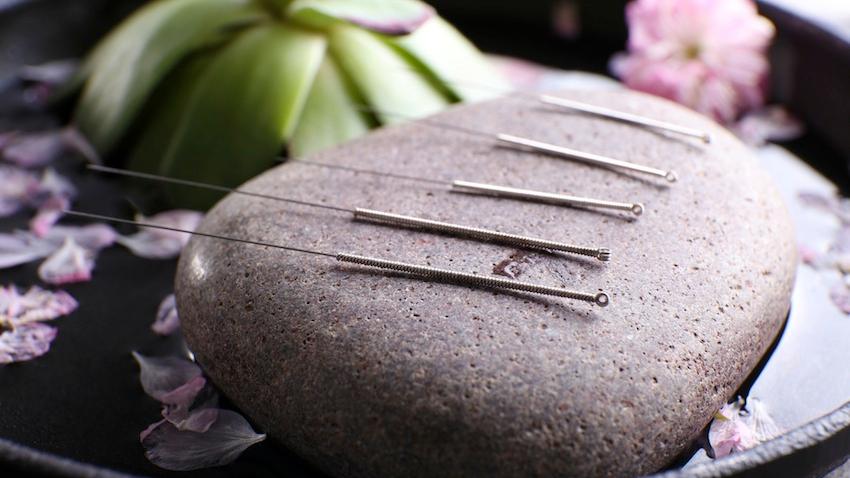 Everything You Need to Know About Community Acupuncture in Vancouver